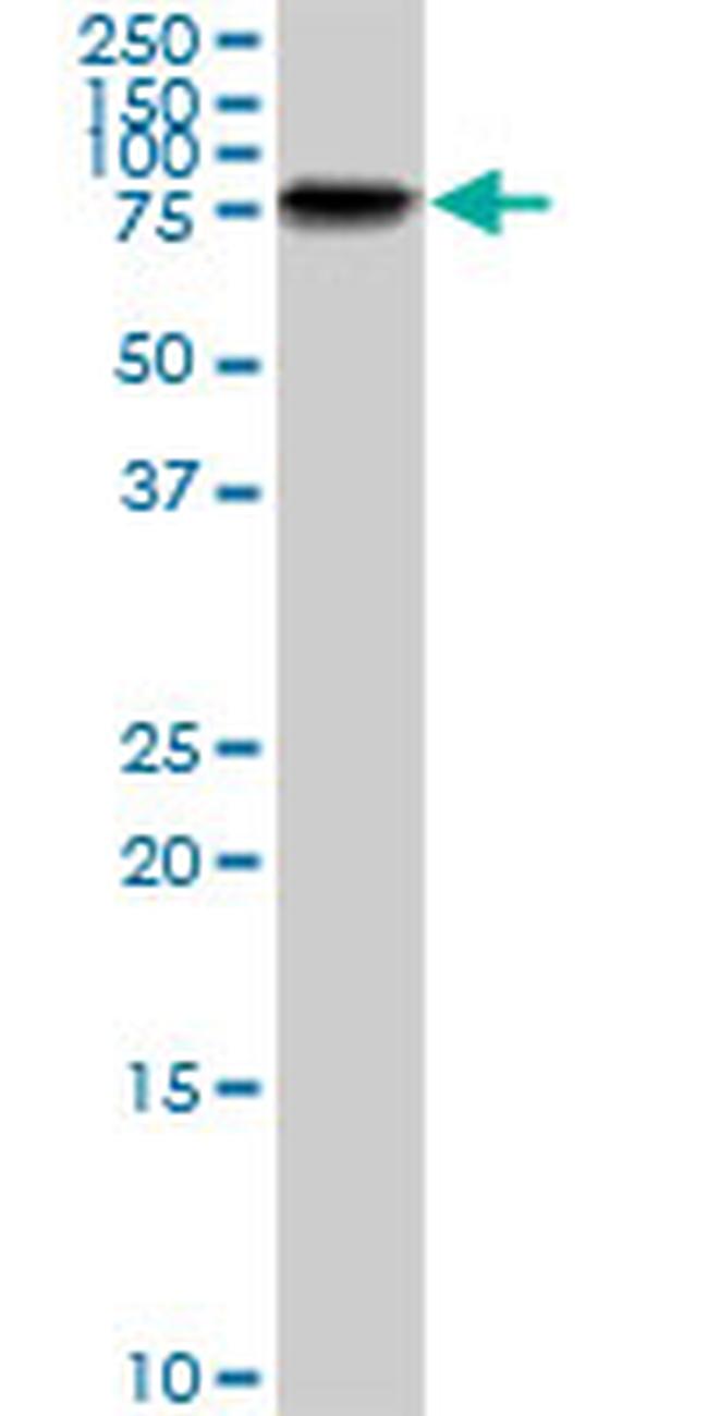 LIMK1 Antibody in Western Blot (WB)