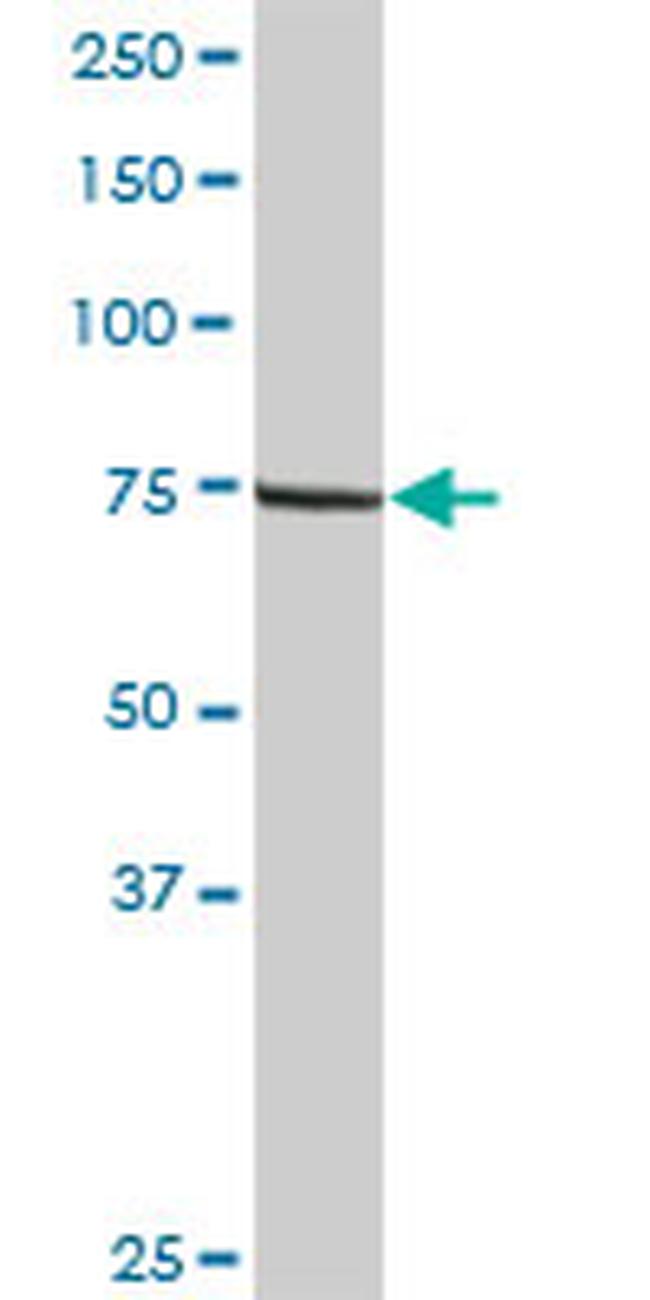 LIMK2 Antibody in Western Blot (WB)