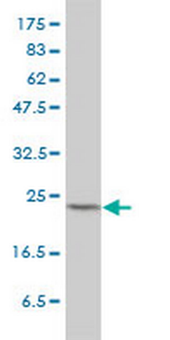 MAD2L1 Antibody in Western Blot (WB)