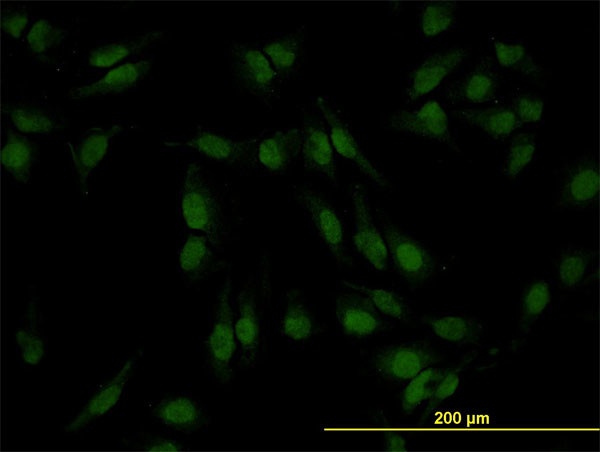 SMAD4 Antibody in Immunocytochemistry (ICC/IF)