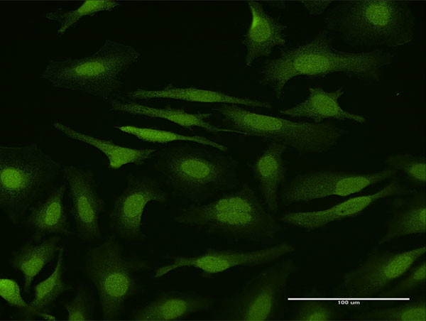 SMAD6 Antibody in Immunocytochemistry (ICC/IF)