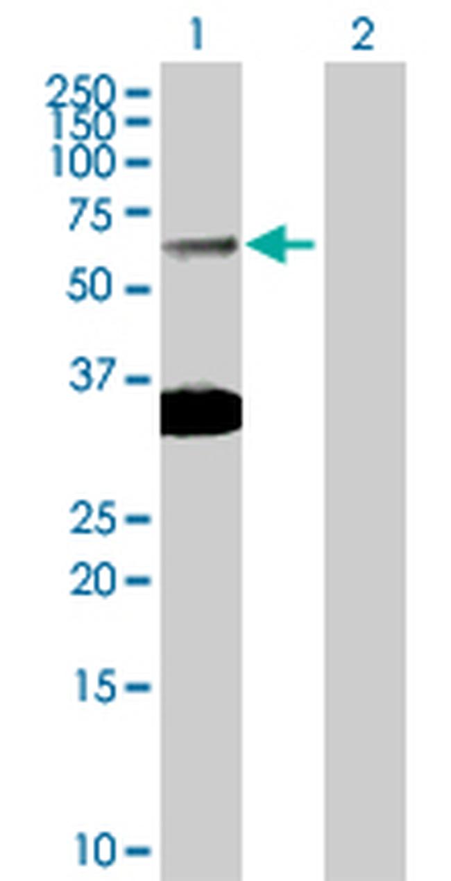 SMAD6 Antibody in Western Blot (WB)