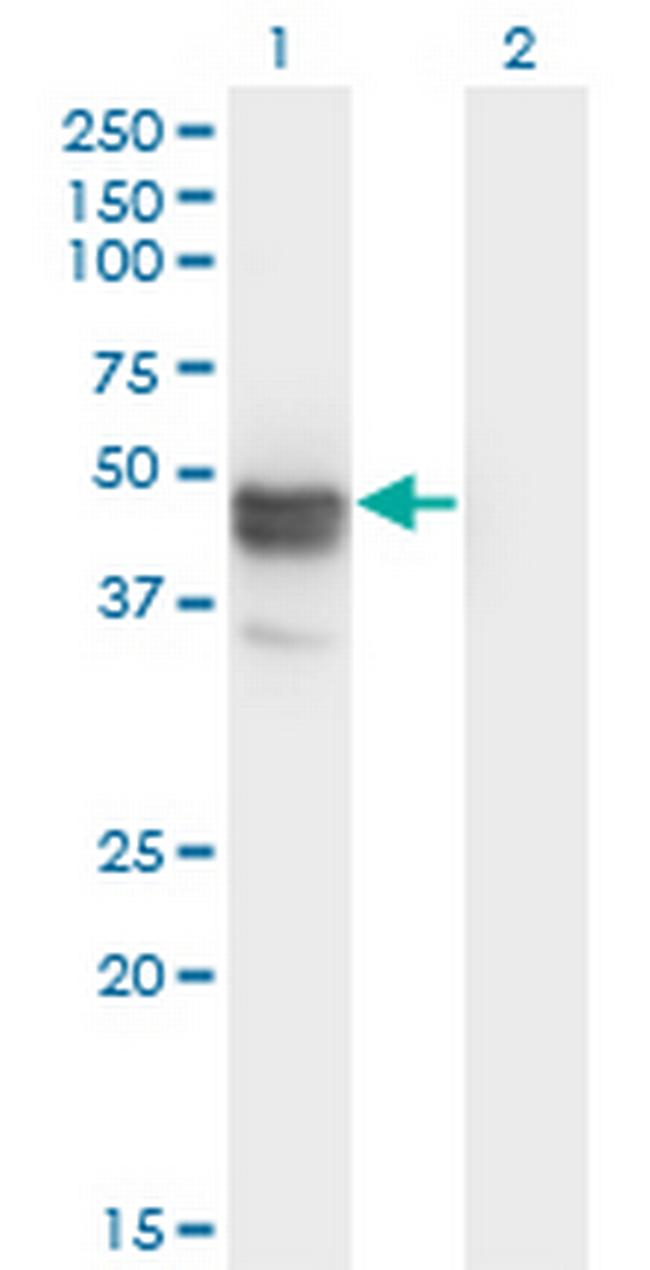 MAGEB1 Antibody in Western Blot (WB)