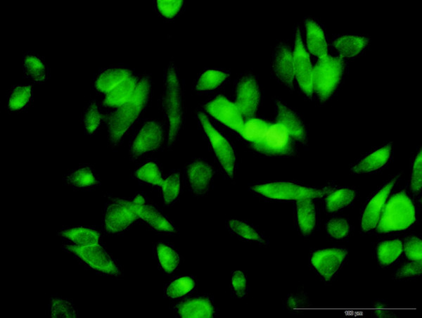 ME1 Antibody in Immunocytochemistry (ICC/IF)