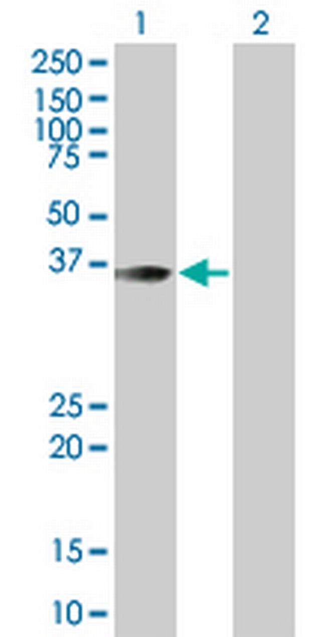 MEF2B Antibody in Western Blot (WB)