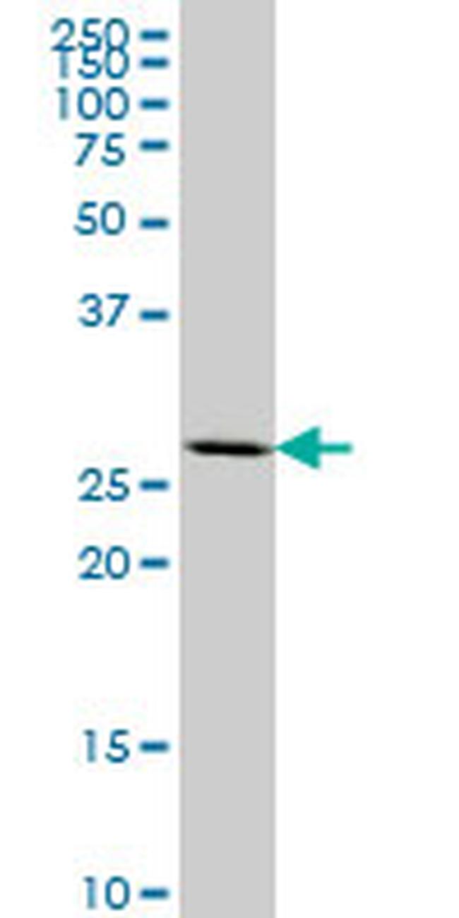 MEOX2 Antibody in Western Blot (WB)