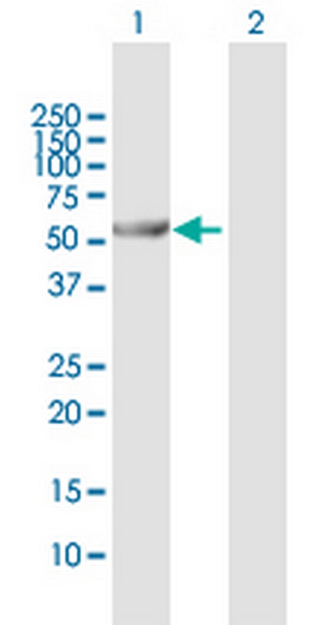 ALDH6A1 Antibody in Western Blot (WB)