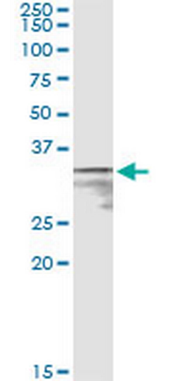 MPST Antibody in Immunoprecipitation (IP)