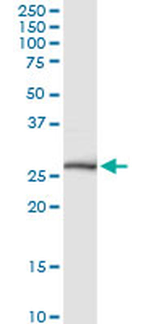 NKX3-1 Antibody in Western Blot (WB)