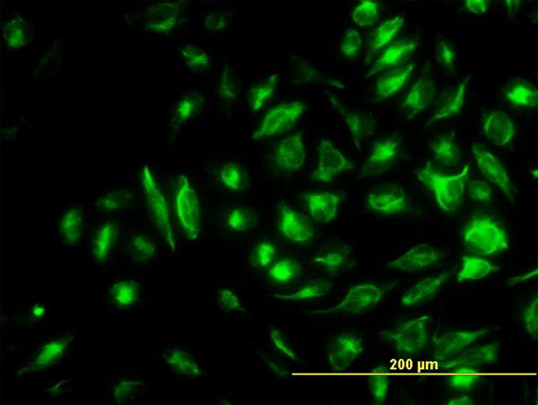 NME2 Antibody in Immunocytochemistry (ICC/IF)