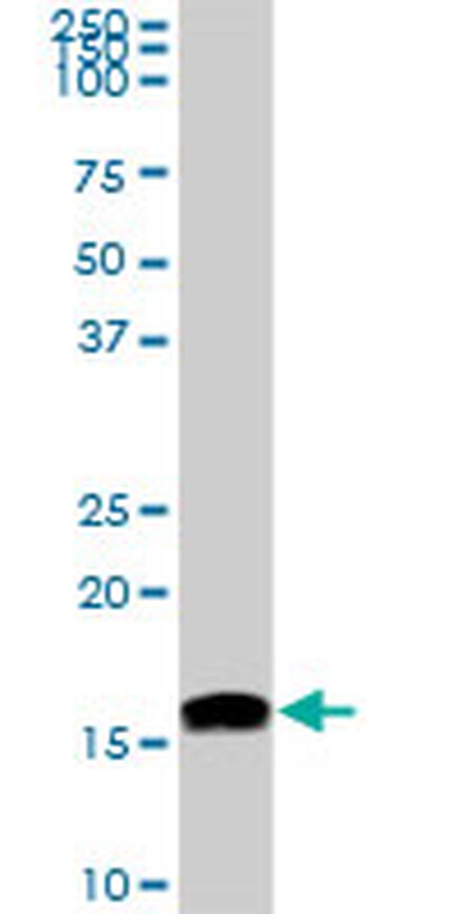 NME2 Antibody in Western Blot (WB)