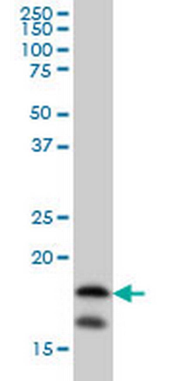 NME2 Antibody in Western Blot (WB)