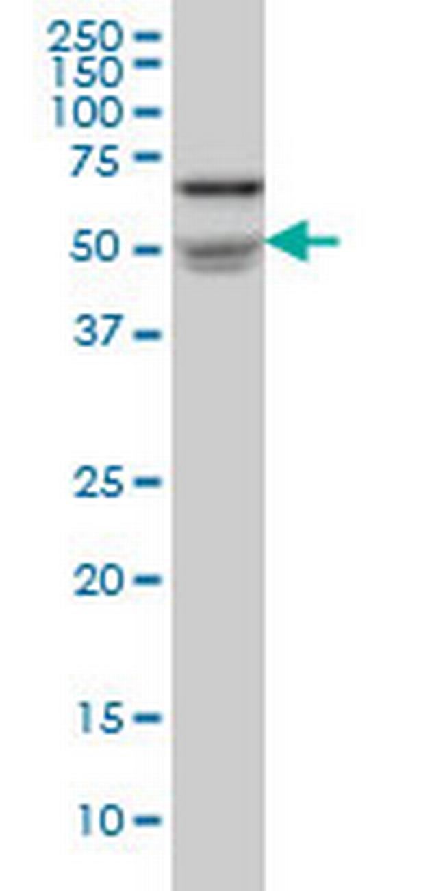 NOVA1 Antibody in Western Blot (WB)