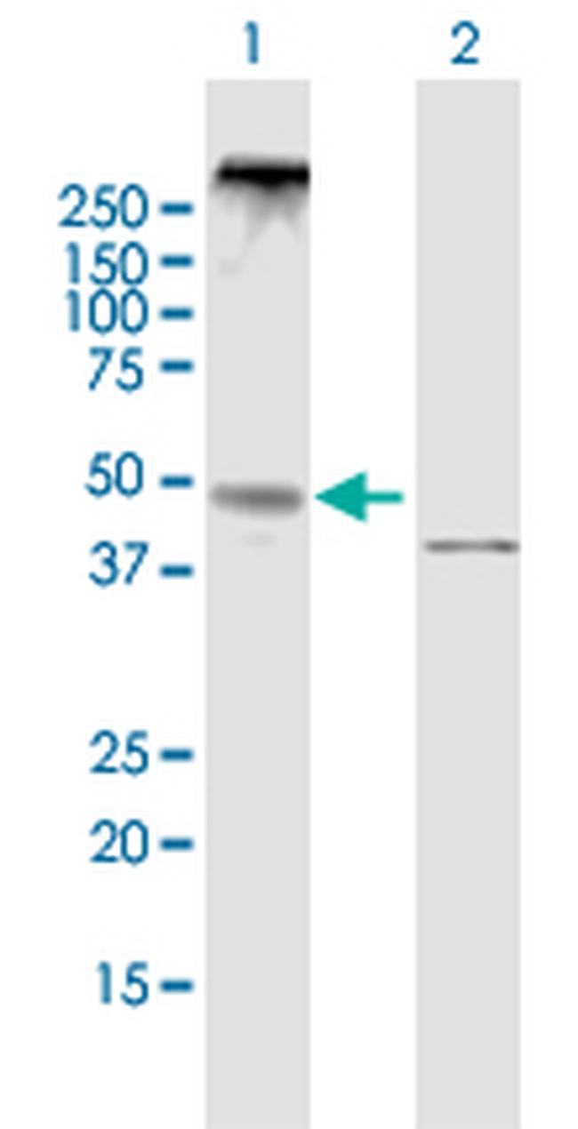 NPY5R Antibody in Western Blot (WB)