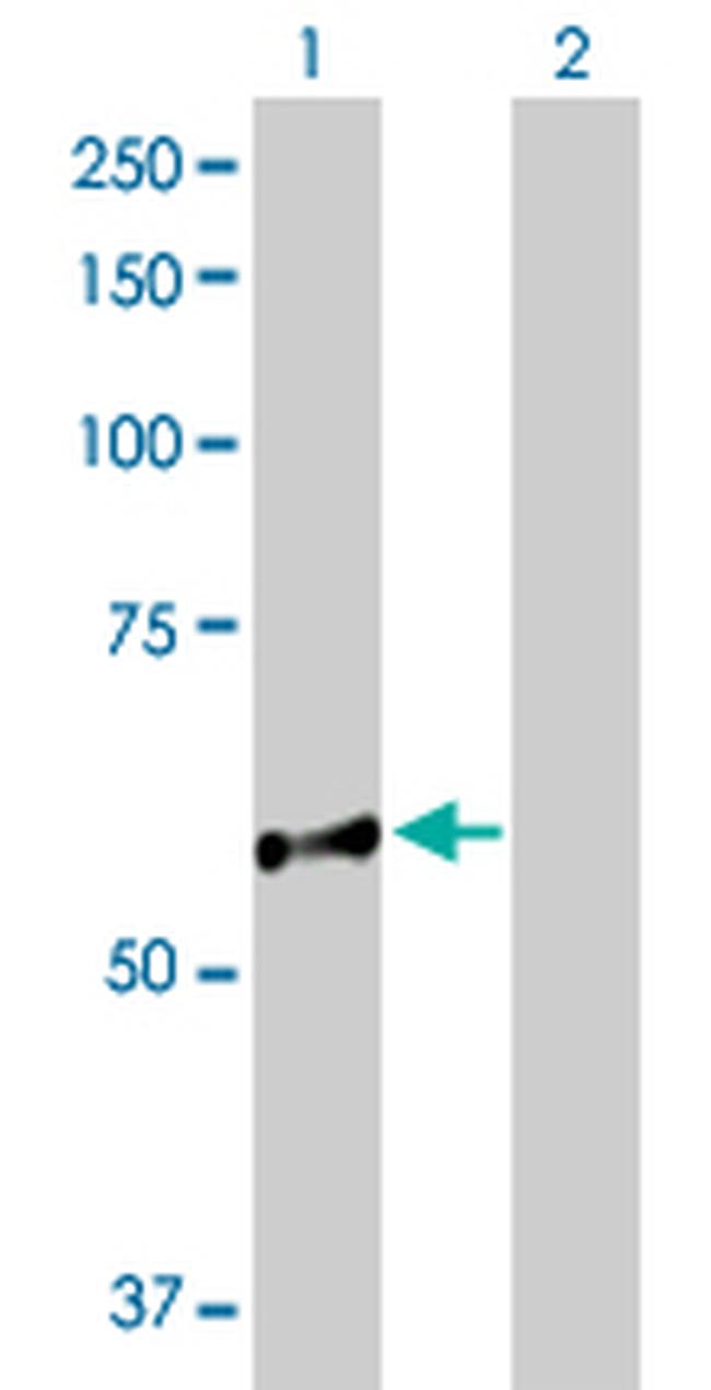 NUP98 Antibody in Western Blot (WB)