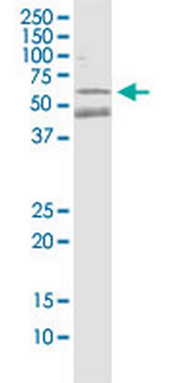 PARK2 Antibody in Western Blot (WB)