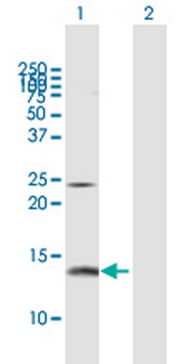 PFN2 Antibody in Western Blot (WB)