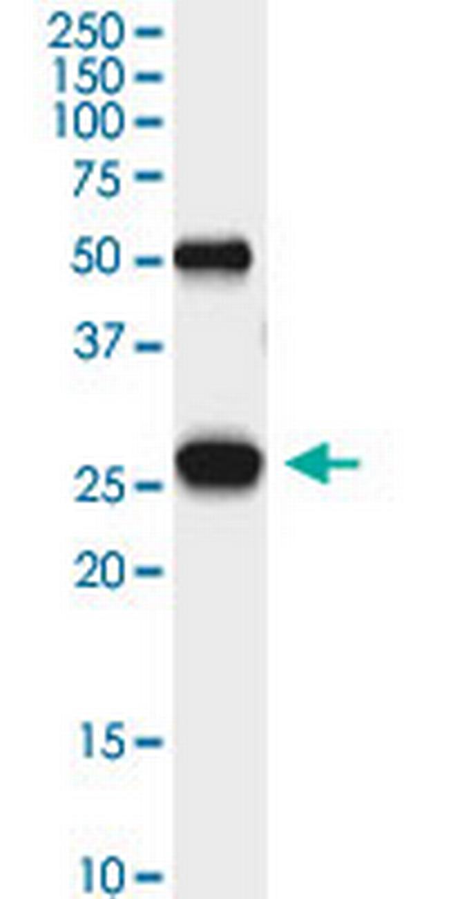 PGAM1 Antibody in Immunoprecipitation (IP)