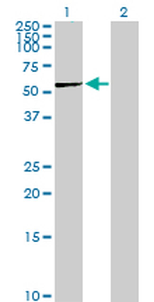 PGD Antibody in Western Blot (WB)