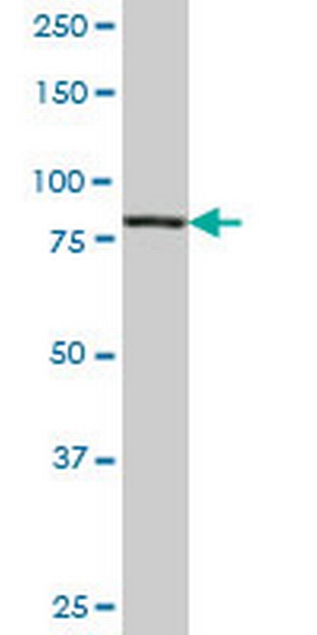 PIK3R1 Antibody in Western Blot (WB)