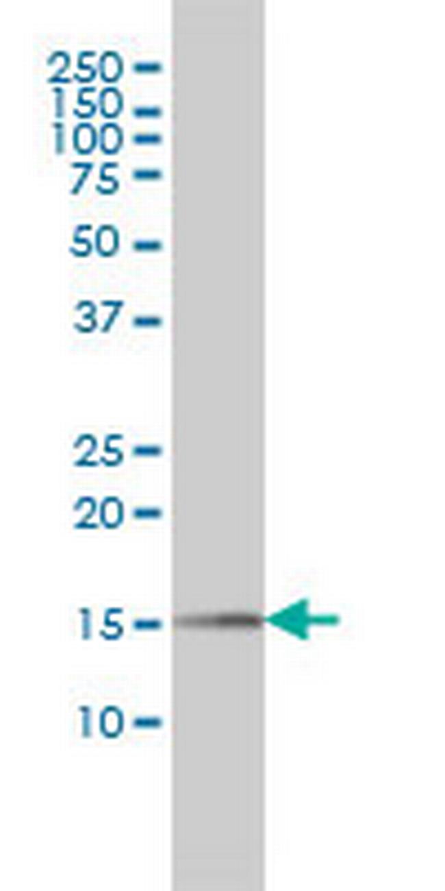 PIN1 Antibody in Western Blot (WB)