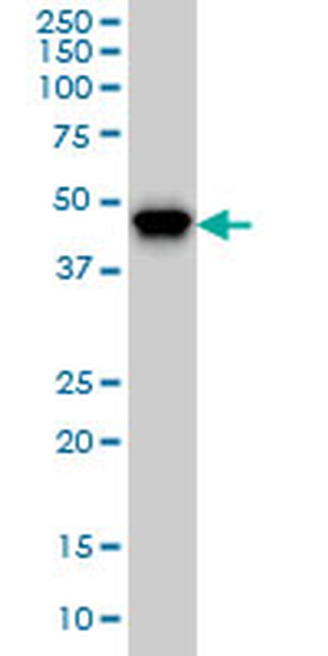 PIP5K2A Antibody in Western Blot (WB)