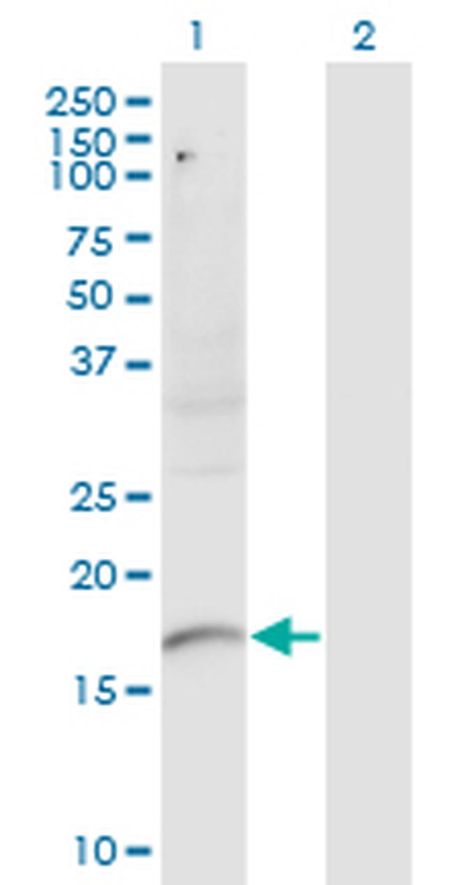 PLXNA2 Antibody in Western Blot (WB)