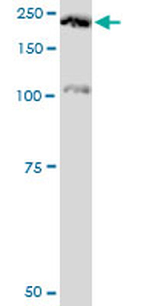 PLXNA2 Antibody in Western Blot (WB)