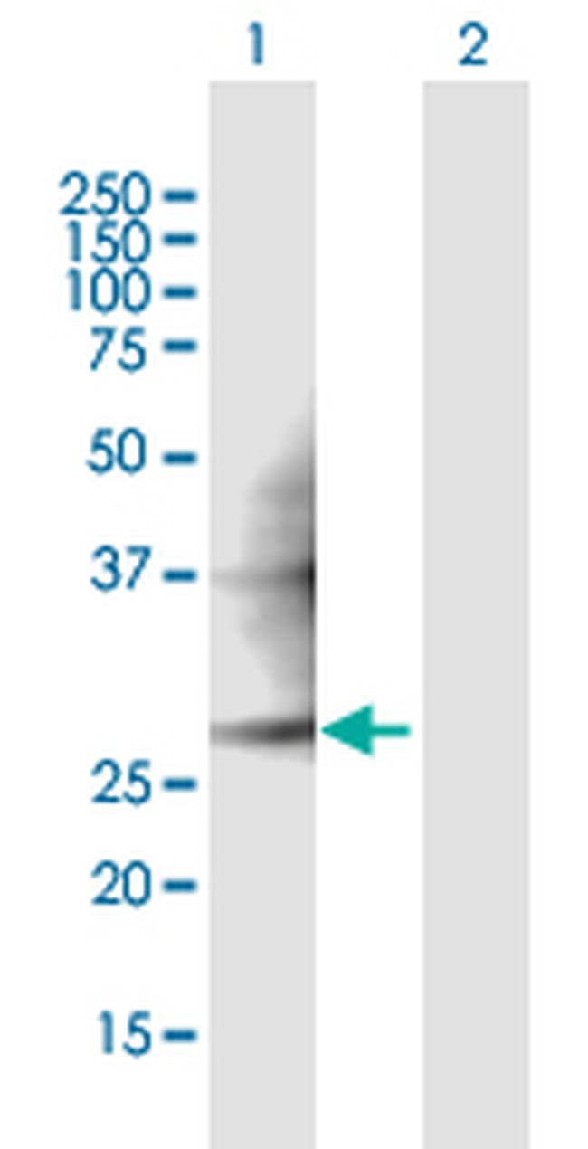 PMM2 Antibody in Western Blot (WB)