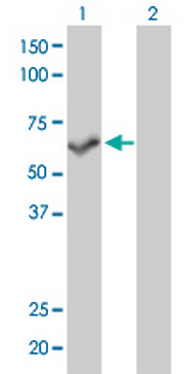 PPP3CB Antibody in Western Blot (WB)