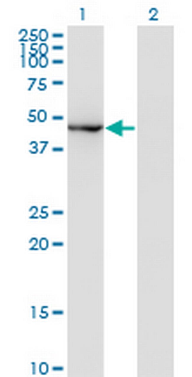 MAPK8 Antibody in Western Blot (WB)