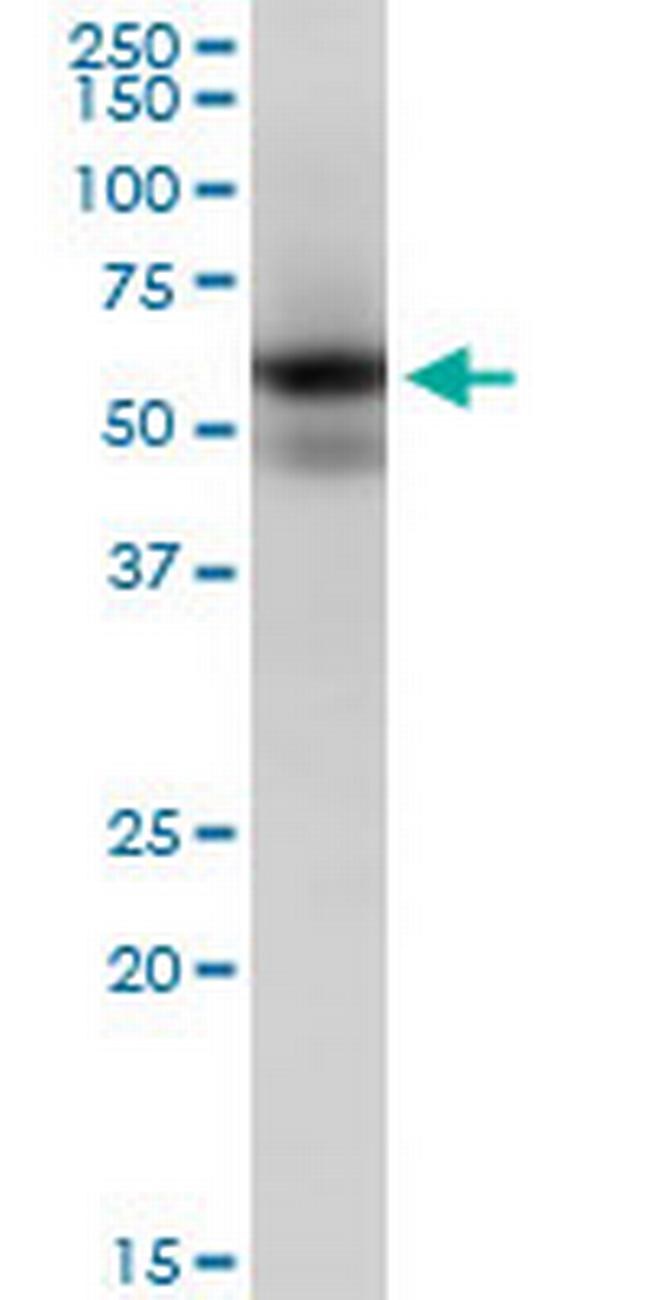 MAPK9 Antibody in Western Blot (WB)