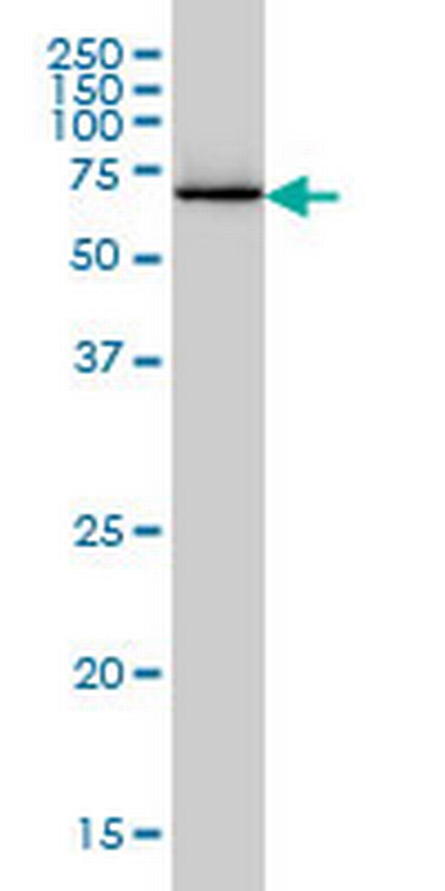 EIF2AK2 Antibody in Western Blot (WB)