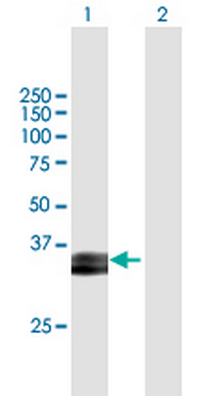 PRSS8 Antibody in Western Blot (WB)