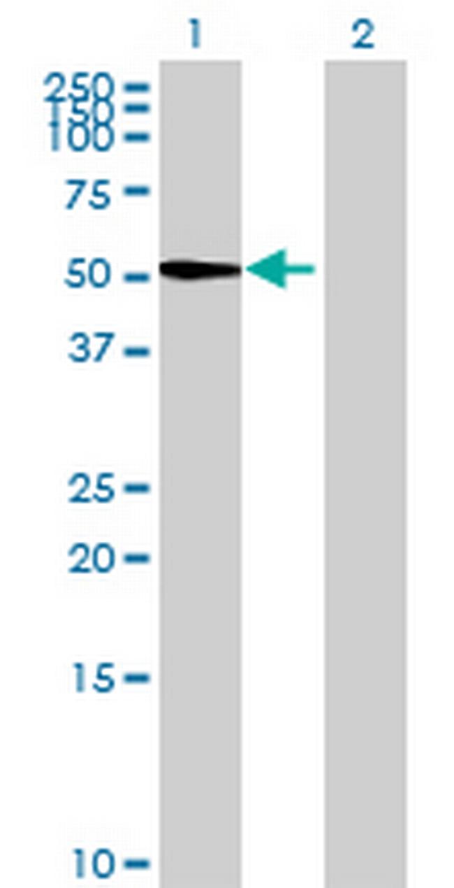 PSG6 Antibody in Western Blot (WB)