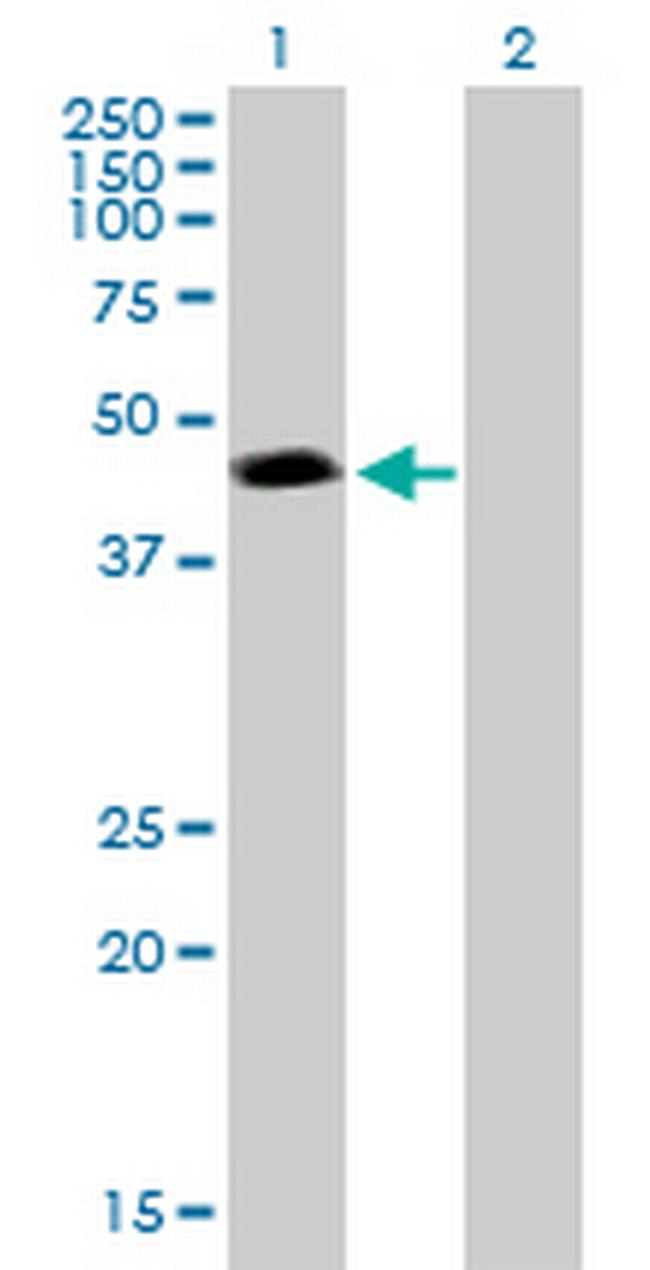 PSMC3 Antibody in Western Blot (WB)