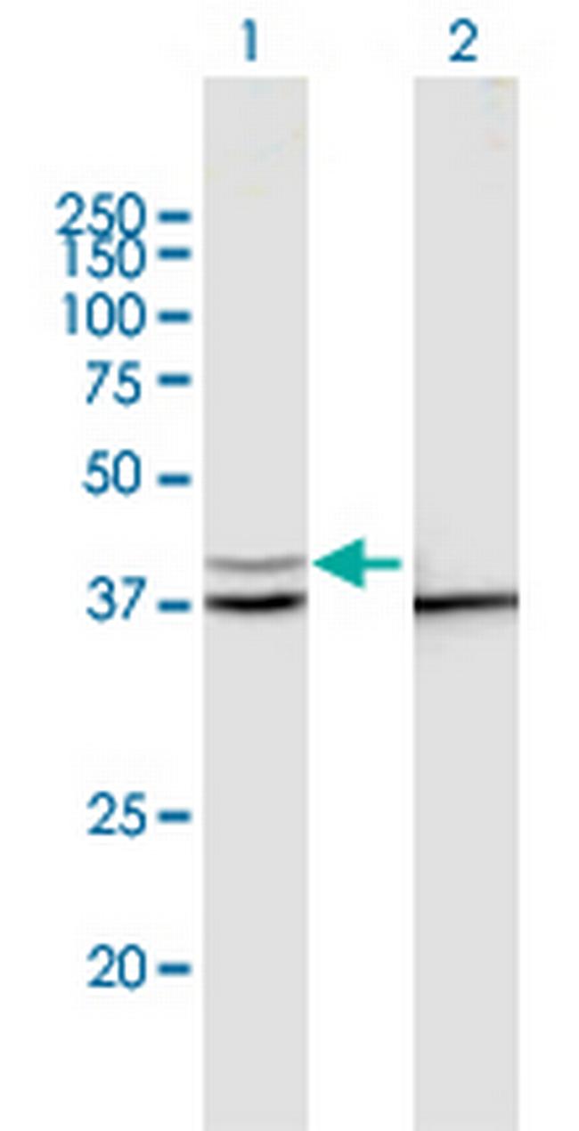 PSMD13 Antibody in Western Blot (WB)