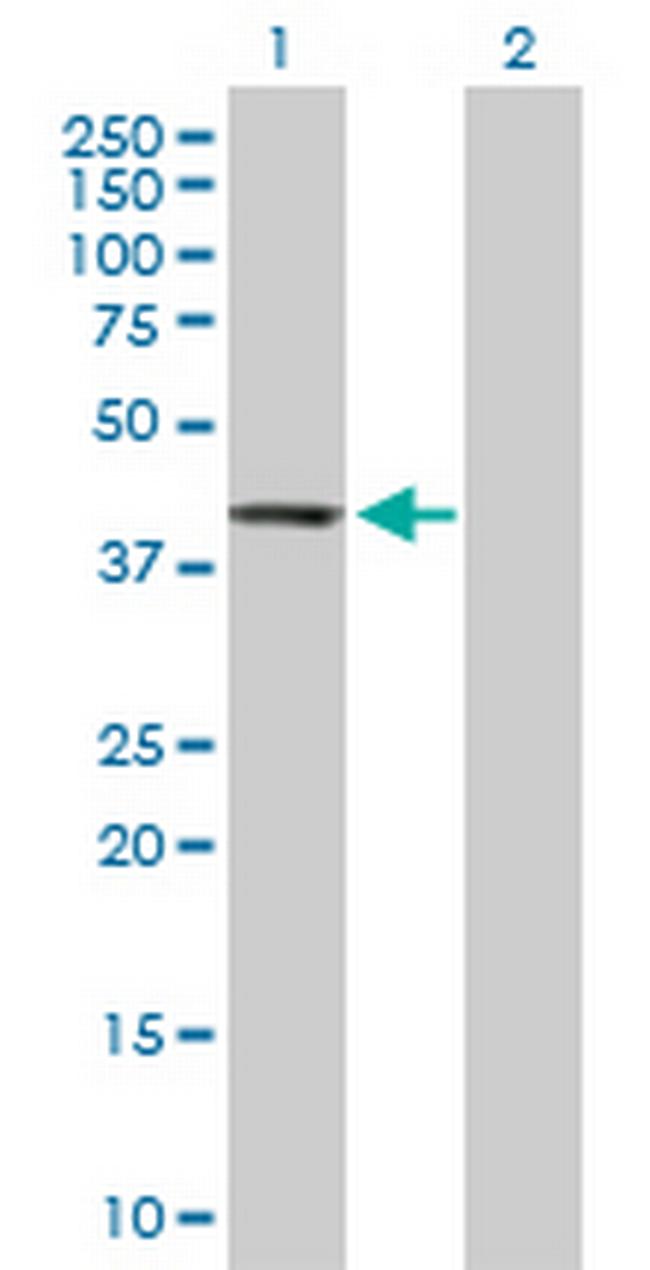 PTPN7 Antibody in Western Blot (WB)