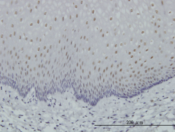 RARA Antibody in Immunohistochemistry (Paraffin) (IHC (P))