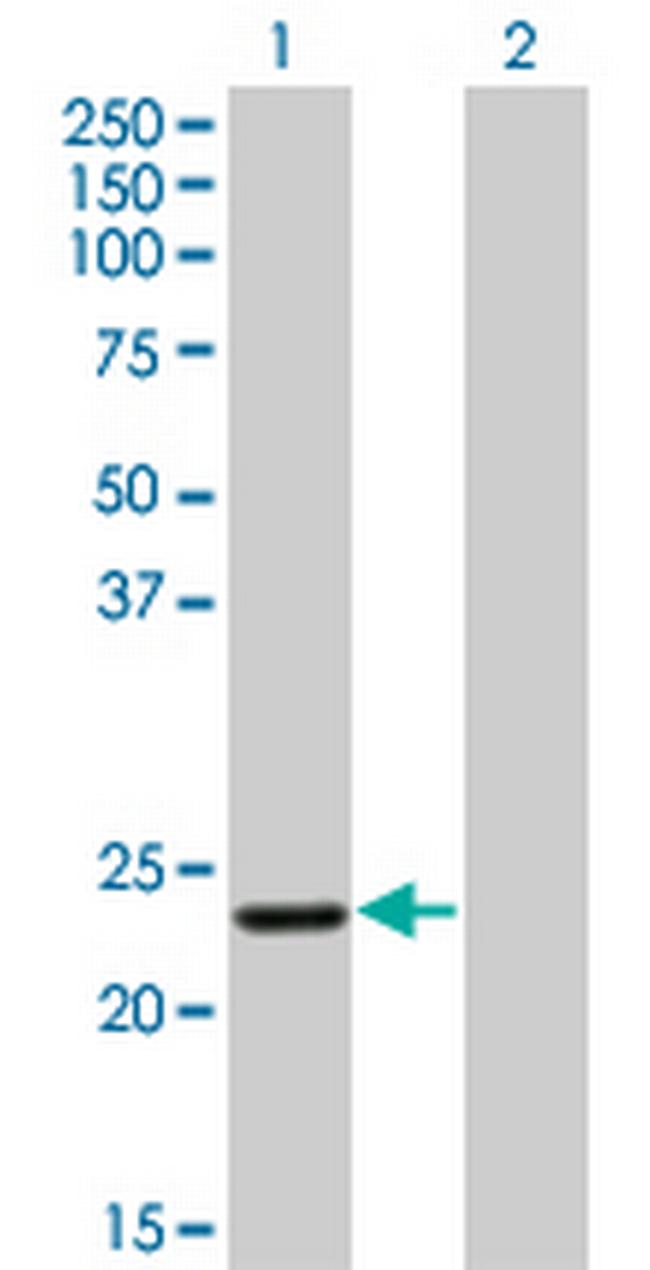 RCV1 Antibody in Western Blot (WB)