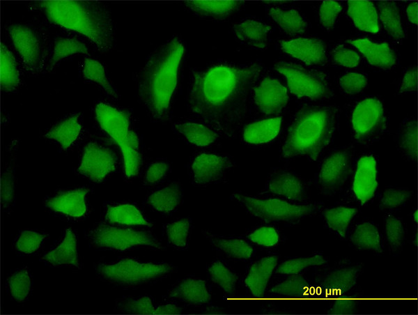 RRM2 Antibody in Immunocytochemistry (ICC/IF)