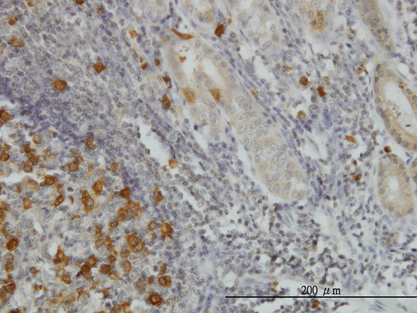 RRM2 Antibody in Immunohistochemistry (Paraffin) (IHC (P))