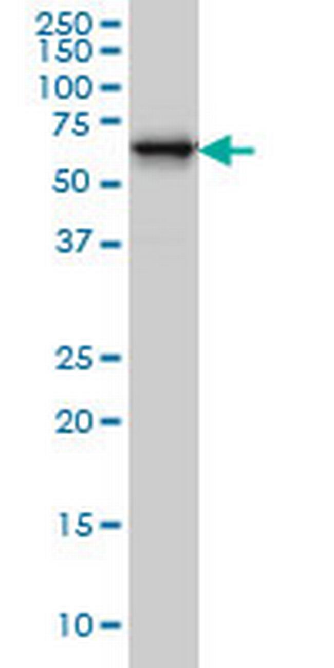 RTKN Antibody in Western Blot (WB)