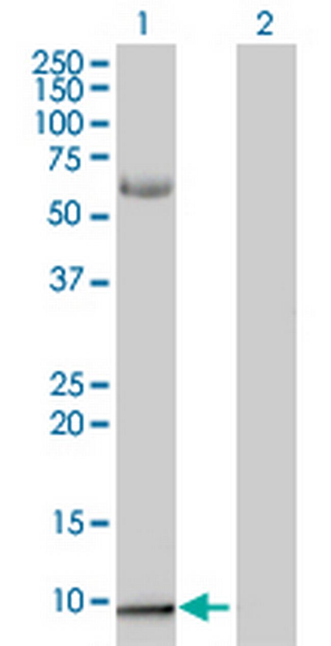 S100A2 Antibody in Western Blot (WB)