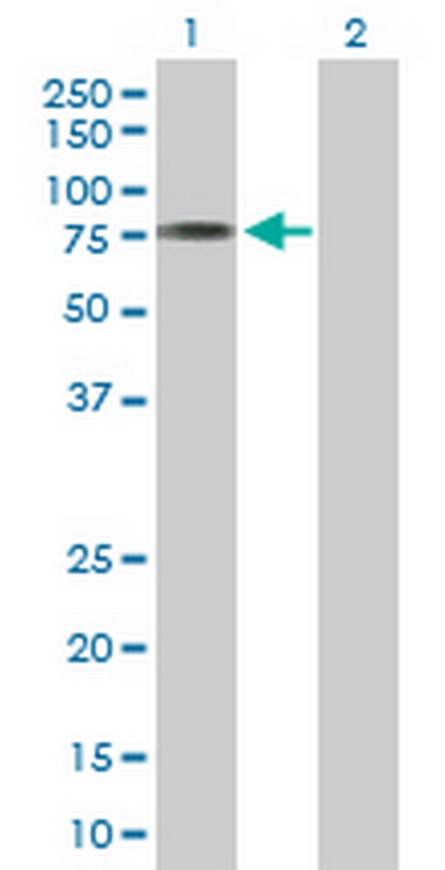 ACSM3 Antibody in Western Blot (WB)