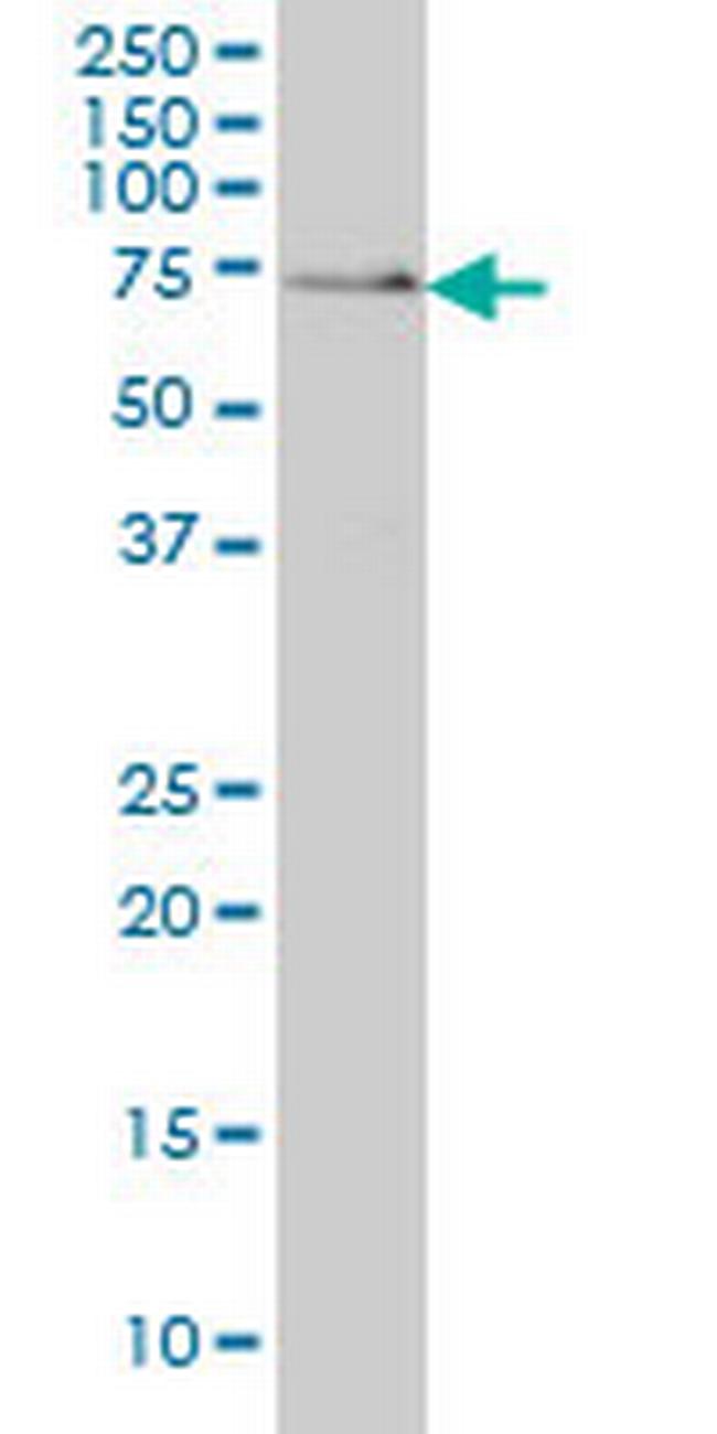 SH3BP2 Antibody in Western Blot (WB)