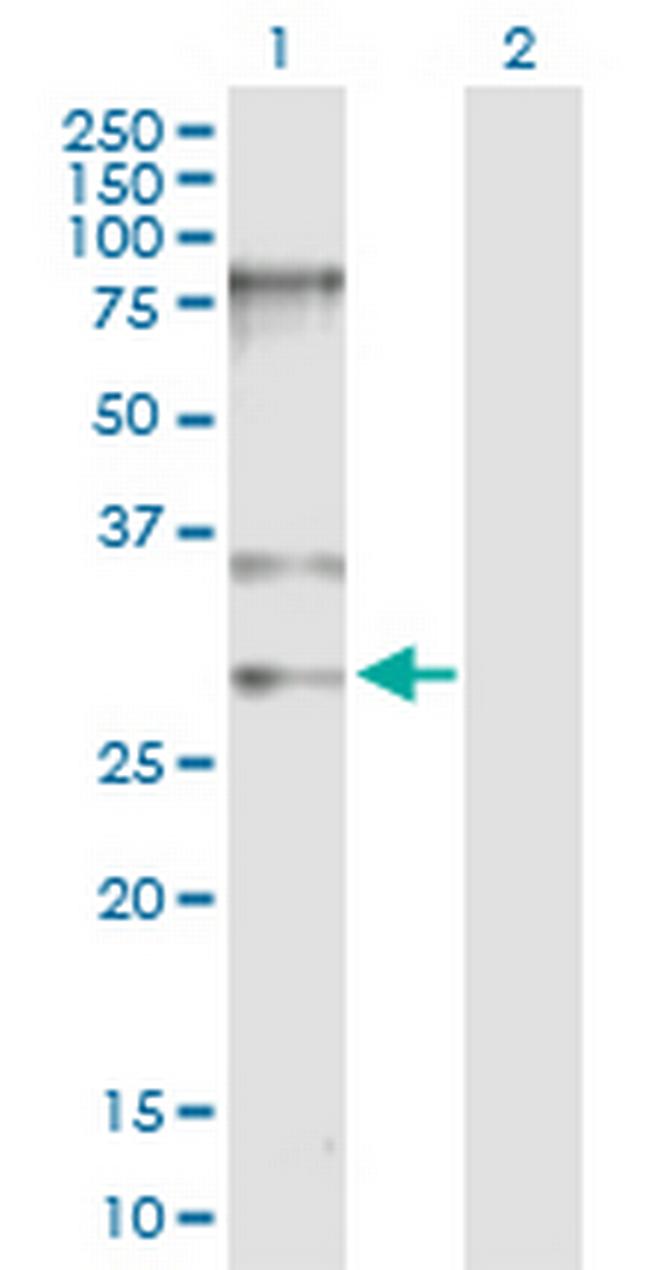 SNRPB Antibody in Western Blot (WB)