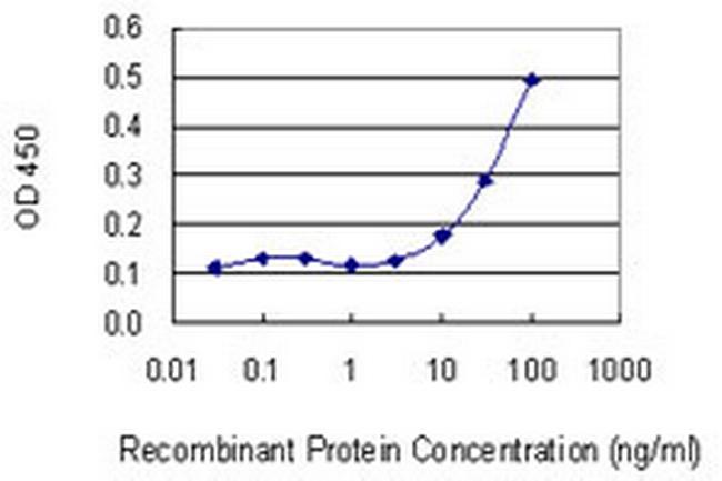 SNRPB Antibody in ELISA (ELISA)