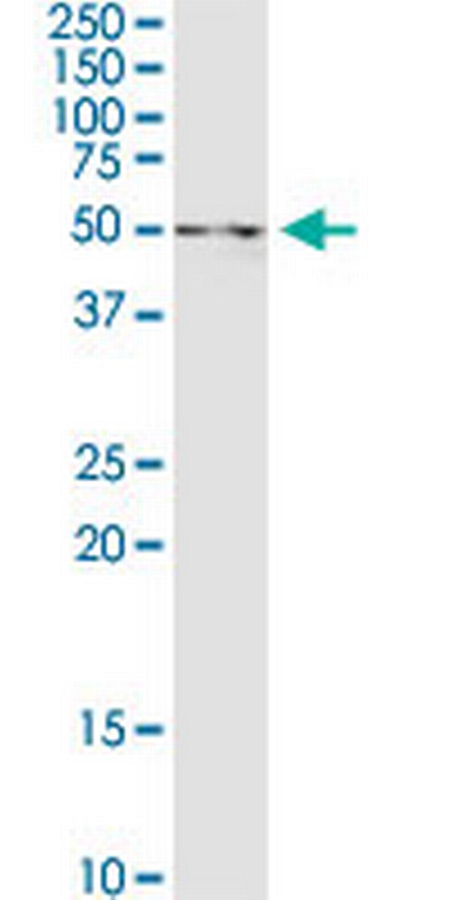 UAP1 Antibody in Western Blot (WB)