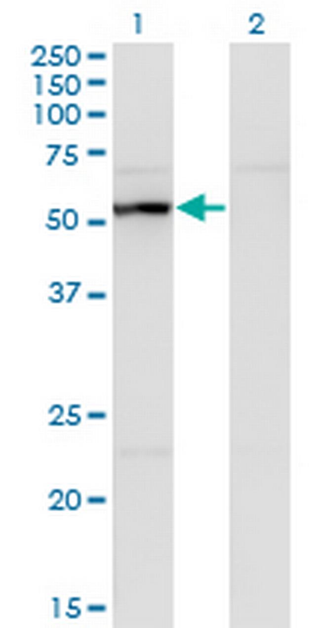 UAP1 Antibody in Western Blot (WB)